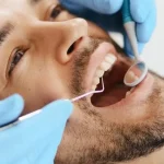 بهترین متخصص ایمپلنت دندان