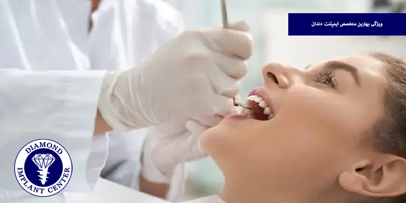 ویژگی بهترین متخصص ایمپلنت دندان