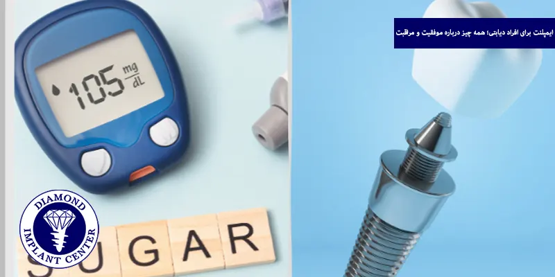 ایمپلنت برای افراد دیابتی؛ همه چیز درباره موفقیت و مراقبت
