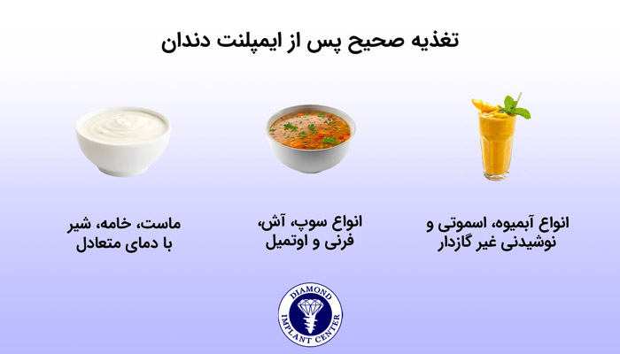 بعد از ایمپلنت چه غذاهایی مصرف کنیم؟