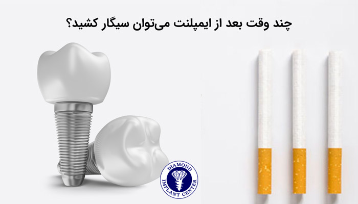 آیا بعد از ایمپلنت میتوان سیگار کشید؟