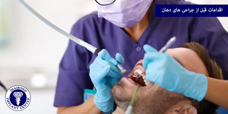 اقدامات قبل از جراحی های دهان