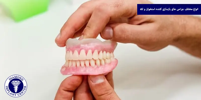 انواع مختلف جراحی های بازسازی کننده استخوان و لثه