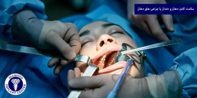 سلامت کامل دهان و دندان با جراحی های دهان