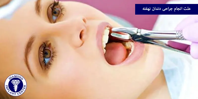 علت انجام جراحی دندان نهفته