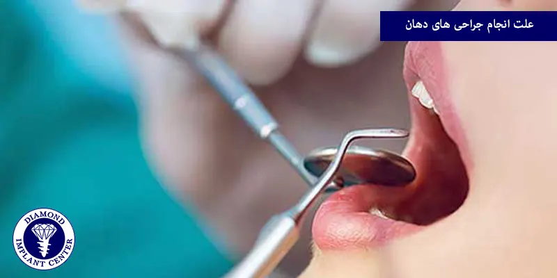علت انجام جراحی های دهان