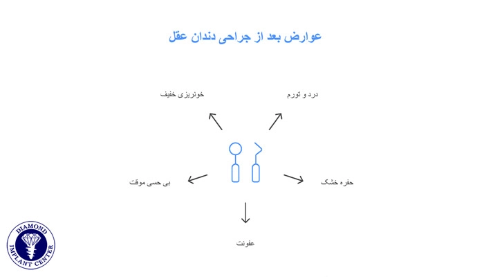 عوارض شایع جراحی دندان عقل
