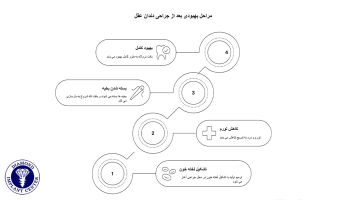مراحل بهبودی دندان عقل پس از جراحی