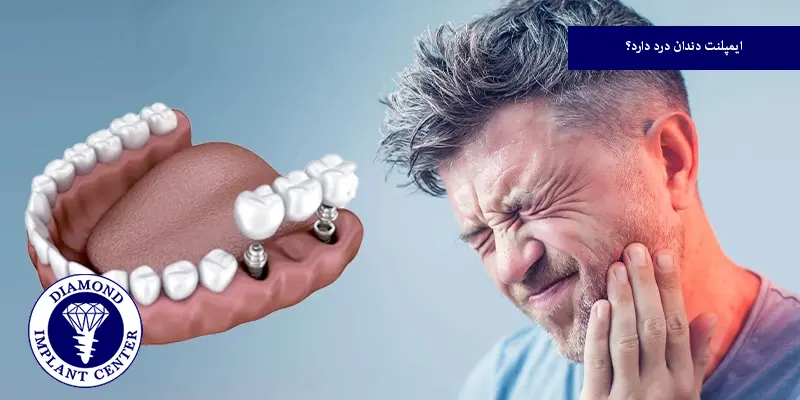 ایمپلنت دندان درد دارد؟