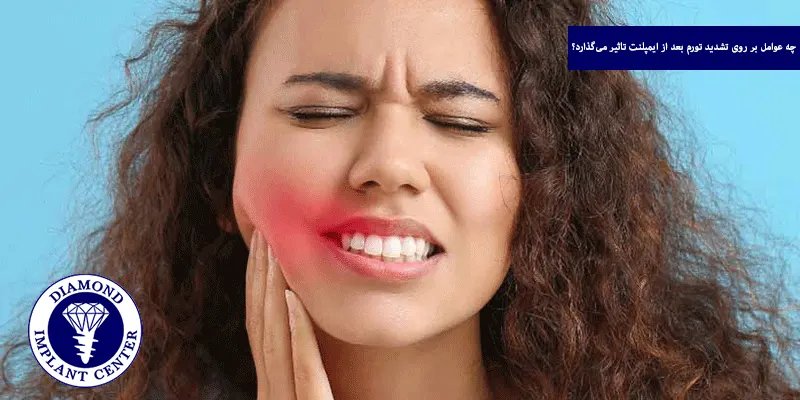 چه عوامل بر روی تشدید تورم بعد از ایمپلنت تاثیر می‌گذارد؟
