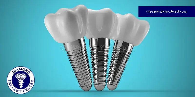 بررسی مزایا و معایب برندهای مطرح ایمپلنت