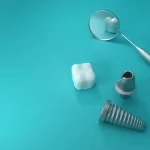 بهترین برند ایمپلنت دندان