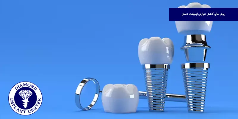 روش های کاهش عوارض ایمپلنت دندان
