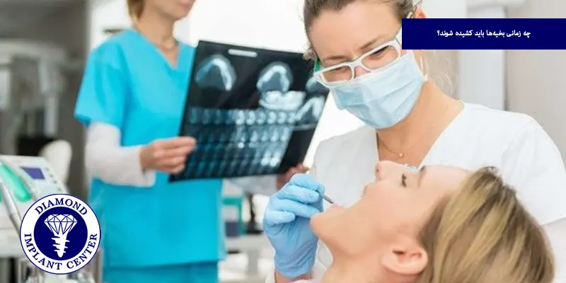 چه زمانی بخیه‌ها باید کشیده شوند؟