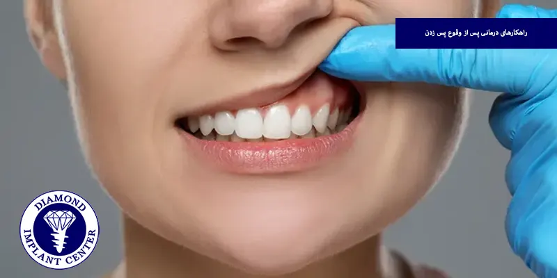 راهکارهای درمانی پس از وقوع پس زدن