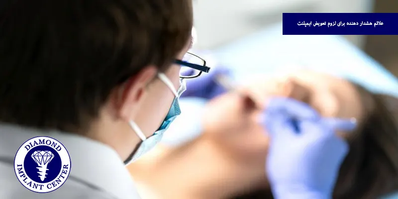 علائم هشدار دهنده برای لزوم تعویض ایمپلنت