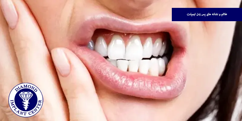 علائم و نشانه های پس زدن ایمپلنت