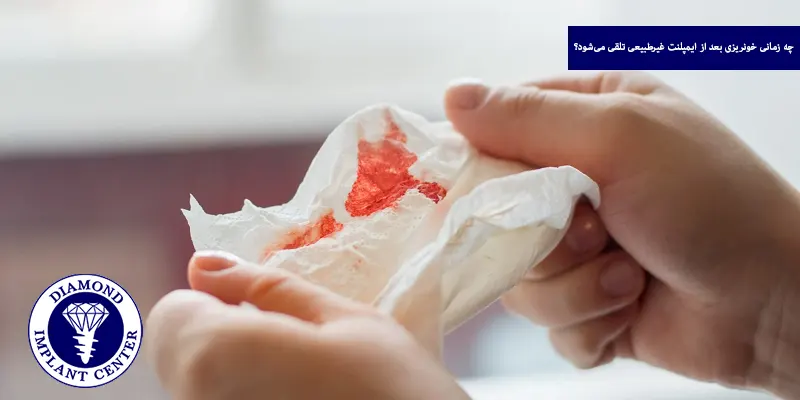 چه زمانی خونریزی بعد از ایمپلنت غیرطبیعی تلقی می‌شود؟