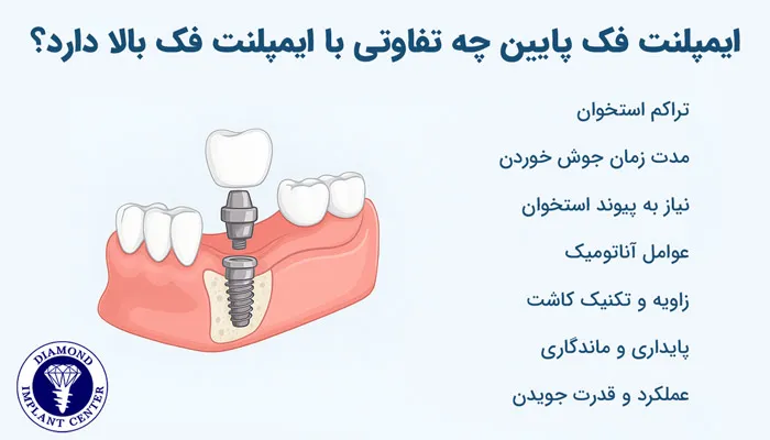 ایمپلنت فک پایین چه تفاوتی با ایمپلنت فک بالا دارد؟