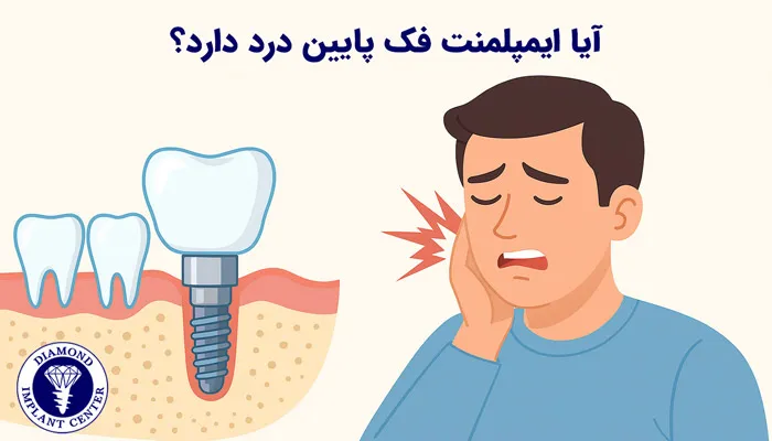 آیا جراحی ایمپلنت فک پایین درد دارد؟
