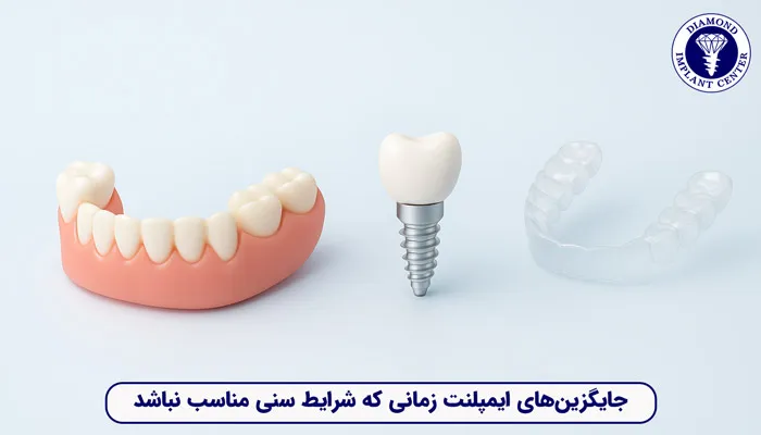 جایگزین های ایمپلنت در زمانی که شراط سنی نامناسب باشد