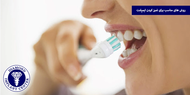روش های مناسب برای تمیز کردن ایمپلنت