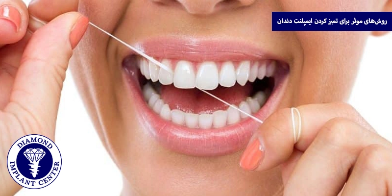 روش‌ های موثر برای تمیز کردن ایمپلنت دندان