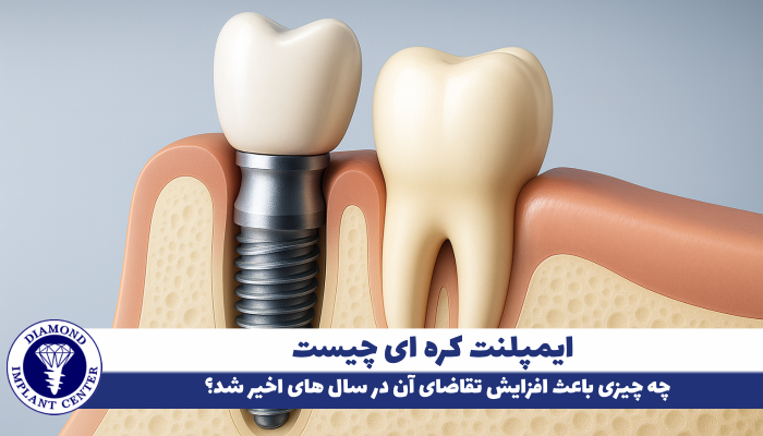 چرا کره جنوبی قطب ایمپلنت دندان شد؟