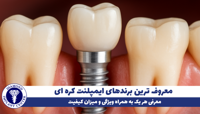 بهترین برندهای ایمپلنت کره ای