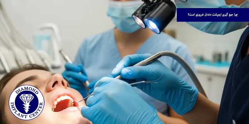 چرا جرم گیری ایمپلنت دندان ضروری است؟