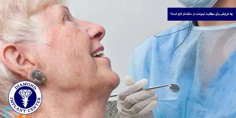 چه شرایطی برای موفقیت ایمپلنت در سالمندان لازم است؟