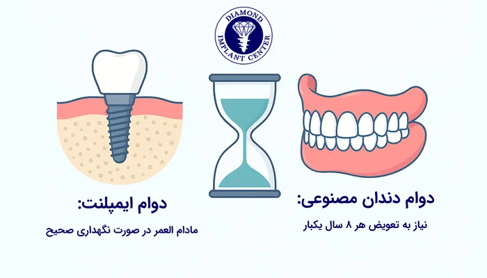 تفاوت ایمپلنت و دندان مصنوعی در طول عمر و دوام