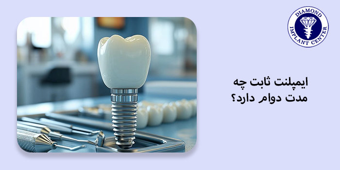 ایمپلنت ثابت چقدر دوام دارد؟