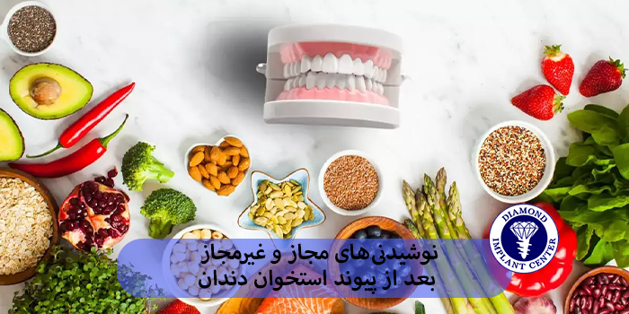 نوشیدنیهای مجاز و غیرمجاز بعد از پیوند استخوان دندان